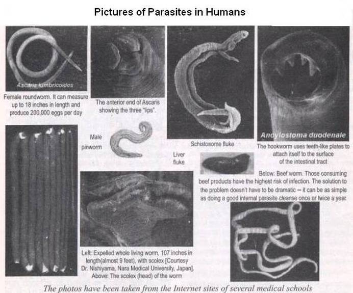 Human Parasite Identification Chart